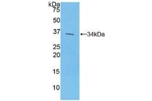 Detection of Recombinant IRF4, Mouse using Polyclonal Antibody to Interferon Regulatory Factor 4 (IRF4) (IRF4 anticorps  (AA 175-433))