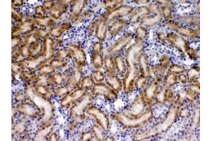IHC analysis of TIMP4 using anti- TIMP4 antibody .