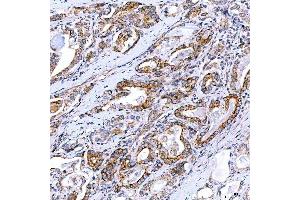 IHC analysis of Rab4/RAB4A using anti-Rab4/RAB4A antibody (ABIN7599733). (Rab4 anticorps  (AA 110-216))