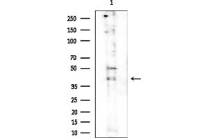 Western blot analysis of lysates from Rat brain, using Phospho-IKB alpha (Ser32/Ser36) Antibody at 1/1000 dilution.