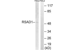 Western blot analysis of extracts from HeLa cells, using RSAD1 antibody. (RSAD1 anticorps  (Internal Region))