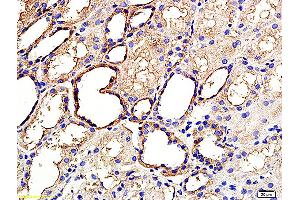 Formalin-fixed and paraffin embedded human kidney labeled with Anti ANGPTL3/ANG5 Polyclonal Antibody, Unconjugated (ABIN759806) at 1:200 followed by conjugation to the secondary antibody and DAB staining (ANGPTL3 anticorps  (AA 21-120))