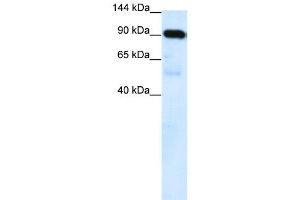 WB Suggested Anti-SUV420H1  Antibody Titration: 0.