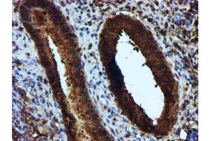 Immunohistochemical staining of paraffin-embedded Human endometrium tissue using anti-KEAP1 mouse monoclonal antibody. (KEAP1 anticorps)