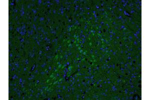 anti-A Kinase (PRKA) Anchor Protein 12 (AKAP12) (AA 701-900) antibody
