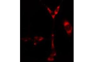 ABIN6276665 staining  Hela cells by IF/ICC. (CYP1B1 anticorps  (Internal Region))