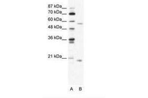 Image no. 1 for anti-Zinc Finger Protein 18 (ZNF18) (N-Term) antibody (ABIN202745) (ZNF18 anticorps  (N-Term))