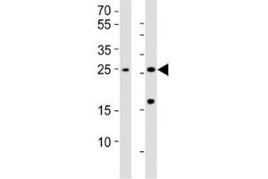 Western blot testing of RHOXF1 antibody at 1:1000; Lane 1: HL-60 whole lysate; Lane 2: human testis lysate. (RHOXF1 anticorps  (AA 85-120))