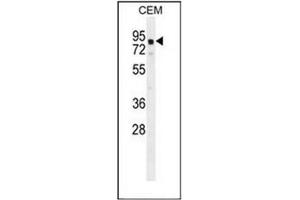 Western blot analysis of GLB1L2 Antibody (C-term) in CEM cell line lysates (35ug/lane). (GLB1L2 anticorps  (C-Term))