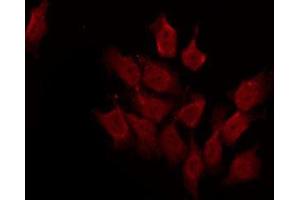 ABIN6276672 staining HeLa by IF/ICC.