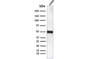Western Blot Analysis for human Liver tissue lysate using Adipophilin Recombinant Rabbit Monoclonal Antibody (ADFP/2755R).