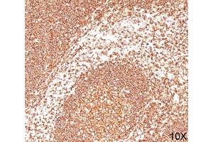 IHC: human tonsil (10X) stained with CD45 antibody (2B11).