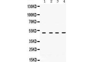 Western Blotting (WB) image for anti-Ribonucleotide Reductase M2 (RRM2) (AA 1-33), (N-Term) antibody (ABIN3043425)