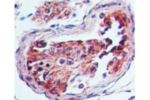 Serotonin Receptor 3A Immunohistochemistry.