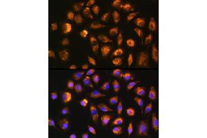 Immunofluorescence analysis of L929 cells using FGF2 Rabbit pAb (ABIN3020744, ABIN3020745, ABIN3020746 and ABIN6213702) at dilution of 1:100 (40x lens). (FGF2 anticorps  (AA 143-288))