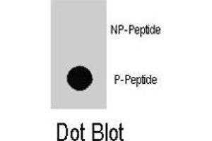 Dot blot analysis of MAP3K7IP1 (phospho S423) polyclonal antibody  on nitrocellulose membrane. (TAB1 anticorps  (C-Term))