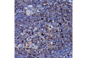 Immunohistochemistry of paraffin-embedded human tonsil using Human IgM Rabbit mAb (ABIN7267845) at dilution of 1:100 (40x lens). (IGHM anticorps)