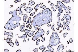 IHC analysis of LNPEP using anti-LNPEP antibody (ABIN7600279). (LNPEP anticorps  (AA 17-994))