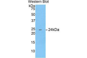 Western Blotting (WB) image for anti-Cathepsin B (CTSB) (AA 129-333) antibody (ABIN1858539) (Cathepsin B anticorps  (AA 129-333))