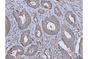 IHC analysis of ARL1 using anti-ARL1 antibody (ABIN7602848).