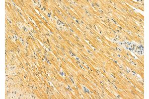 ABIN6265094 and ABIN6278291 at 1/100 staining Rat heart tissue by IHC-P. (SIRT5 anticorps  (Internal Region))