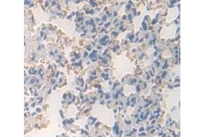IHC-P analysis of Mouse Tissue, with DAB staining. (PDGFRL anticorps  (AA 22-375))