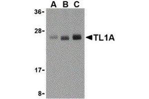 Western Blotting (WB) image for anti-Tumor Necrosis Factor (Ligand) Superfamily, Member 15 (TNFSF15) (N-Term) antibody (ABIN2476844)