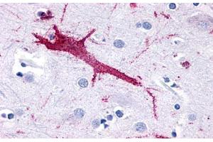 Anti-GPR116 antibody  ABIN1048694 IHC staining of human brain, neuron. (G Protein-Coupled Receptor 116 anticorps  (N-Term))