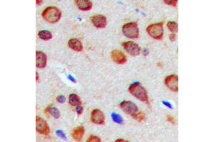 Immunohistochemical analysis of Nogo staining in human brain formalin fixed paraffin embedded tissue section.