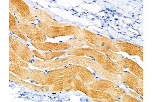 ABIN6258888 and ABIN6274835 at 1/100 staining Rat skin tissue by IHC-P. (SGCA anticorps  (Internal Region))