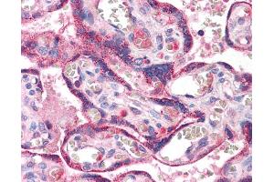 Immunohistochemistry (IHC) image for anti-RING1 and YY1 Binding Protein (RYBP) (Middle Region) antibody (ABIN2777441)