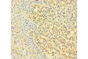Immunohistochemistry of paraffin-embedded human tonsil tissue using ABIN7167200 at dilution of 1:100 (RAC2 anticorps  (AA 1-189))