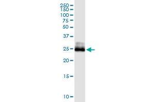 Immunoprecipitation of CITED1 transfected lysate using anti-CITED1 MaxPab rabbit polyclonal antibody and Protein A Magnetic Bead , and immunoblotted with CITED1 monoclonal antibody (M01), clone 6G8 .