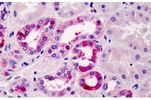 Human Kidney: Formalin-Fixed, Paraffin-Embedded (FFPE) (TFEC anticorps  (AA 217-228))
