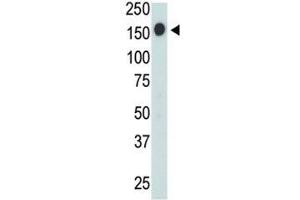 CD45 antibody used in western blot to detect CD45 in Jurkat cell lysate
