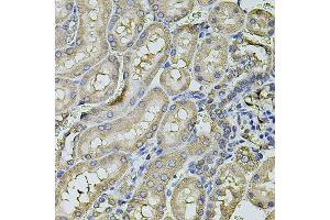 Immunohistochemistry of paraffin-embedded rat kidney using FDX1 antibody (ABIN6003547) at dilution of 1/100 (40x lens). (Ferredoxin1 (FDX1) anticorps)