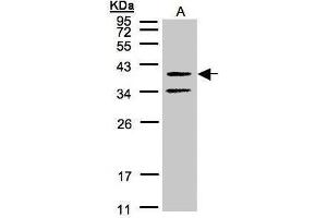 WB Image Sample(30 μg of whole cell lysate) A:A431, 12% SDS PAGE antibody diluted at 1:500 (GALR2 anticorps  (C-Term))