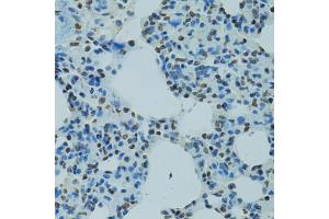 Immunohistochemistry of paraffin-embedded rat lung using AHR antibody (ABIN5970677) at dilution of 1/100 (40x lens). (Aryl Hydrocarbon Receptor anticorps)
