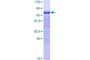 Image no. 1 for Sarcoglycan, alpha (50kDa Dystrophin-Associated Glycoprotein) (SGCA) (AA 1-387) protein (GST tag) (ABIN1319794)