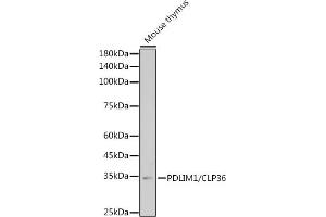 Western blot analysis of extracts of Mouse thymus, using PDLIM1/CLP36 antibody (ABIN7269195) at 1:1000 dilution.