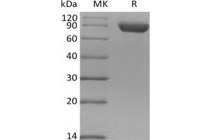 Western Blotting (WB) image for Sialic Acid Binding Ig-Like Lectin 8 (SIGLEC8) protein (Fc Tag) (ABIN7319854)