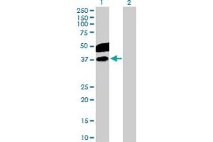 Western Blot analysis of CDC123 expression in transfected 293T cell line by CDC123 MaxPab polyclonal antibody. (CDC123 anticorps  (AA 1-336))