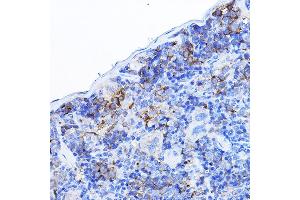 Immunohistochemistry of paraffin-embedded mouse spleen using LCK Rabbit pAb (ABIN3023129, ABIN3023130, ABIN3023131 and ABIN6219404) at dilution of 1:100 (40x lens).