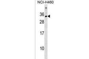 KRBOX1 Antibody (C-term) (ABIN1537656 and ABIN2838166) western blot analysis in NCI- cell line lysates (35 μg/lane). (KRBOX1 anticorps  (C-Term))
