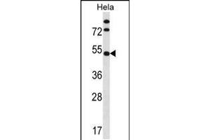 Western blot analysis in Hela cell line lysates (35ug/lane). (IP6K1 anticorps  (N-Term))