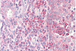 ABIN185519 (5µg/ml) staining of paraffin embedded Human Tonsil.