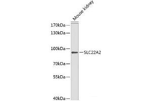 Western blot analysis of extracts of Mouse kidney using SLC22A2 Polyclonal Antibody at dilution of 1:1000. (SLC22A2 anticorps)