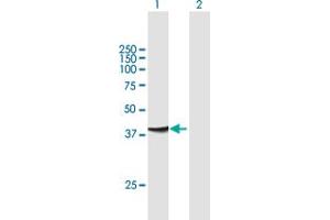 Western Blot analysis of ADAP1 expression in transfected 293T cell line by ADAP1 MaxPab polyclonal antibody. (ADAP1 anticorps  (AA 1-374))