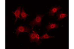 ABIN6268929 staining K562 by IF/ICC. (TRAF2 anticorps  (C-Term))
