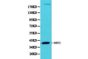 Western Blotting (WB) image for anti-Sirtuin 2 (SIRT2) antibody (ABIN1874785) (SIRT2 anticorps)